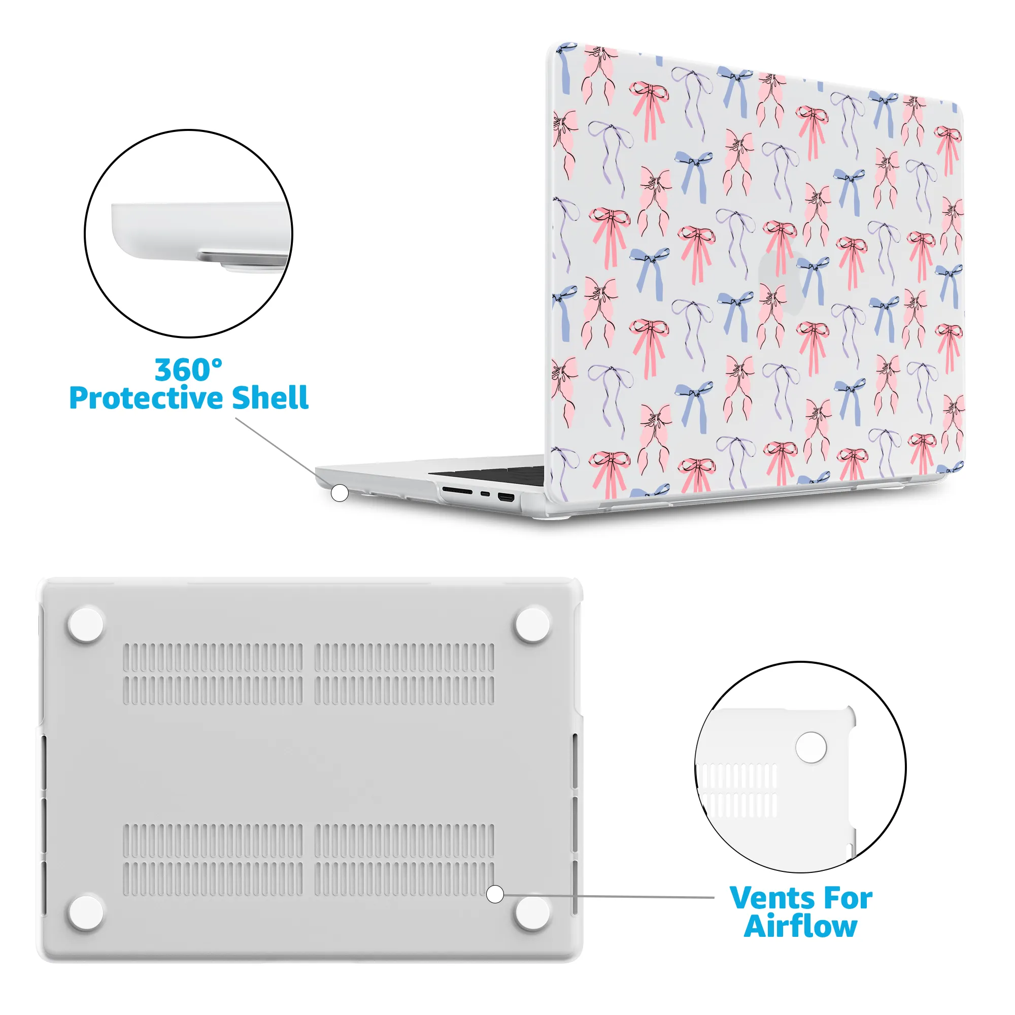 Coquette Girlie | Pastel Bows Laptop Shell - Image 5